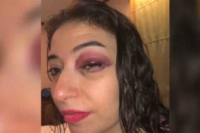 عيني كانت هتروح .. ماذا حدث لـ غادة رجب بعد حفل زفافها